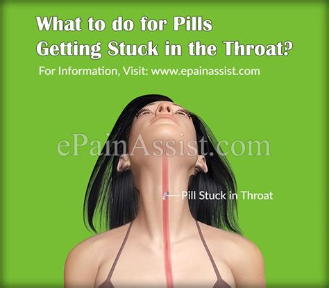 Maybe you would like to learn more about one of these? Pill stuck in chest how to get it down > THAIPOLICEPLUS.COM