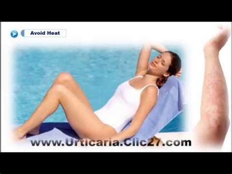 Getting an accurate diagnosis and treatment may relieve the itch. How To Stop Urticaria Itching | How To Stop Hives Itching ...