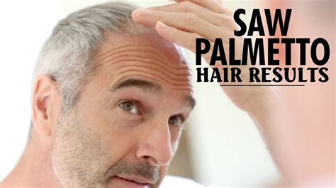 That's really not long enough to gauge any long lasting benefit of saw palmetto for hair loss! Saw Palmetto Hair Loss Results - Does it Help Grow Hair ...