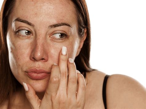 Rossore in Viso: perché succede? come porvi rimedio? - NIVEA