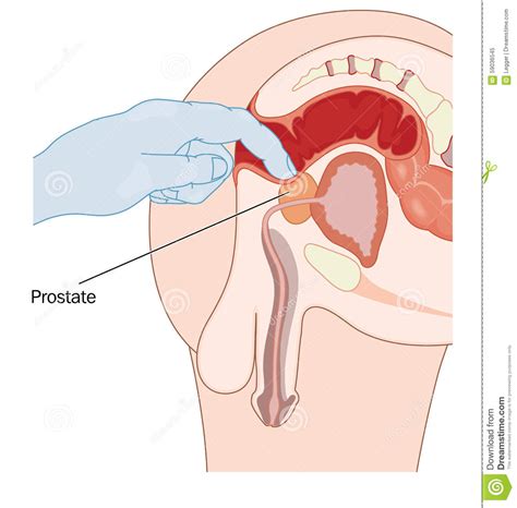 Prostate stimulation and massage is beginning to lose some of the stigma and negativity that has surrounded it for many years. Hoden melken - sextreffen tönisvorst