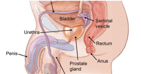 Why does prostate cancer happen? Prostate Cancer : Symptoms, Causes, Diagnosis, Treatment