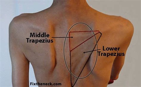 The lower back and hip share many groups of muscles. Anatomy Between Hip Lower Ribcage In Back / Rib Fracture ...