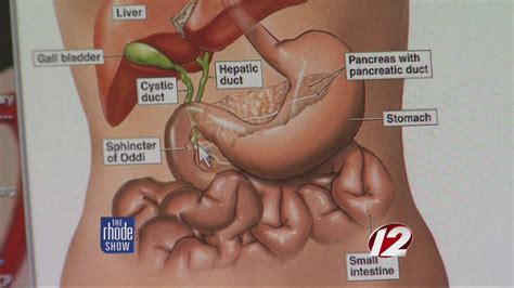 Tests and procedures to stage pancreatic cancer are usually done at the same time as diagnosis. Pancreatic Cancer Awareness - YouTube