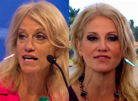Doch viele zuschauer interessierte am sonntag eher die optik der moderatorin. Did Trump hag KellyAnne Conway get some plastic surgery in ...