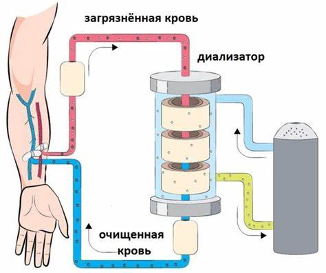 Показания диеты это