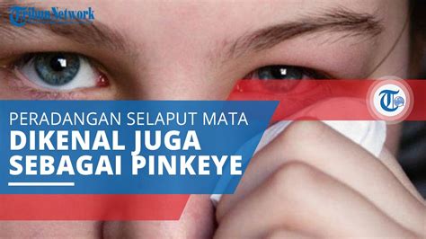 Tell us what you think abut this post by leaving your comments below. Konjungtivitis, Peradangan Selaput Bening yang Menutupi ...