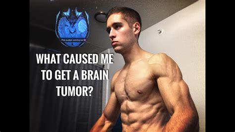 Brain tumor lesion than neoplasia suspected. What caused me to get a BRAIN TUMOR? - YouTube