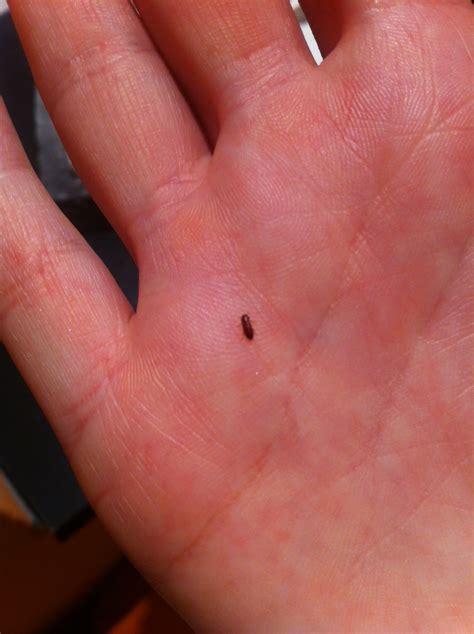 Ist das ein Floh oder Käfer? (Flöhe)