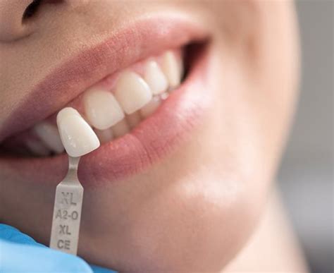 Because more complex procedures are required. How Much Does Teeth Cleaning Cost in Canada? - North York ...