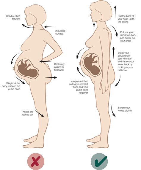 Many broken ribs are merely cracked. Lower Right Back Pain Early Sign Pregnancy - PregnancyWalls