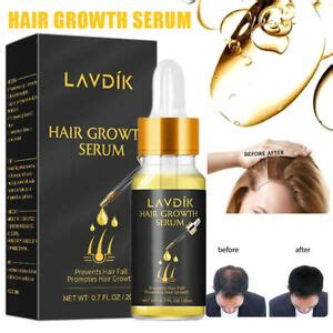 Essential oils hair growth serum recipe: LAVDIK Ginger Fast Hair Growth Serum Essential Oil Anti ...