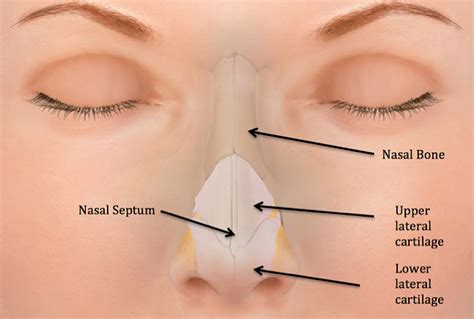 …by the vomer and the nasal, lachrymal, and turbinate bones. Nasal Fracture - Facial Trauma