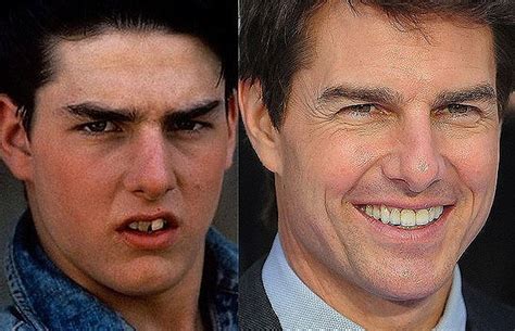 So tom cruise would turn away from his daughter because he has no real choice. Pin auf zähne