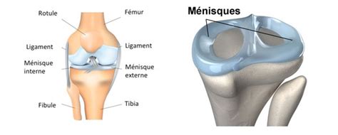 There is no designated classification or naming convention for lesions. Lésions du ménisque