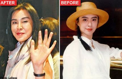 From a very young age, he followed his father to hospitals and sat at the nurse's counter while his dad attended to patients on the wards in the evenings. Plastic surgery? Joey Wong's face looks out of shape and ...