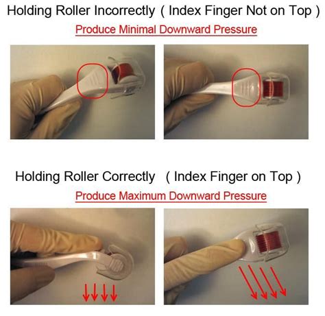 It is gently rolled in different directions over the surface of your skin to achieve the same effect. Pin on Derma Roller