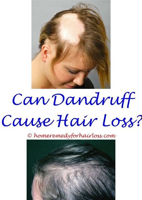 Get a free case evaluation causes of excessive hair loss in older females - hair loss ...