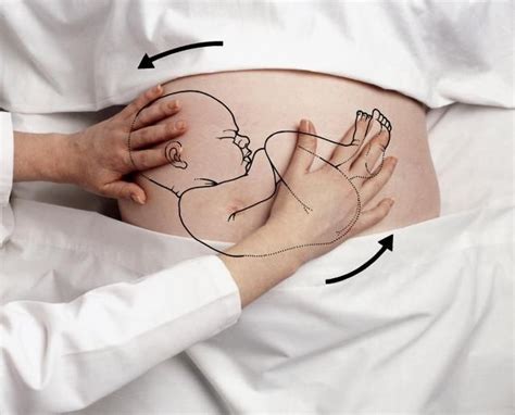 Bayi opick dan wulan ini meninggal dunia dalam kandungan di usia delapan bulan. 5 Petua Berkesan 'Memusingkan' Bayi Songsang Dalam Kandungan