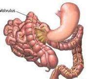 Put simply, bowel obstruction refers to any blockage or barrier within the small or large intestines that prevents partially digested food, digestive juices however, this condition should be taken seriously otherwise it can cause some very critical complications. Partial Bowel Obstruction | Med-Health.net