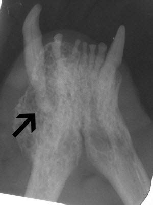 Extraction Complications: Part 3