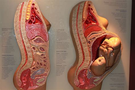 Some women have health problems before they become pregnant that could lead to complications. The Art of Pregnancy | the "Human Body" exhibit at the ...