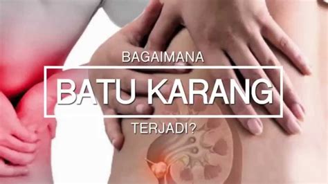 Tetapi dalam istilah perubatan, nama penyakit. PUNCA BATU KARANG BY GLAMOHEALTH PEMECAH BATU KARANG - YouTube