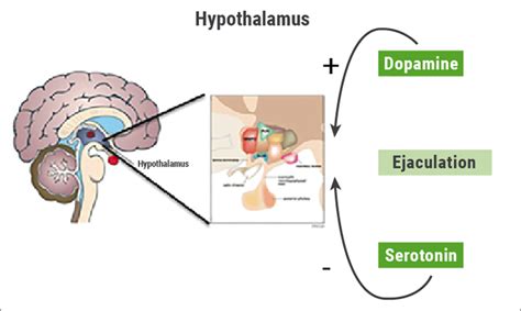 Like premature ejaculation, delayed ejaculation can be caused by psychological and physical factors. Conference Highlights - EAU 2019: male-infertility ...