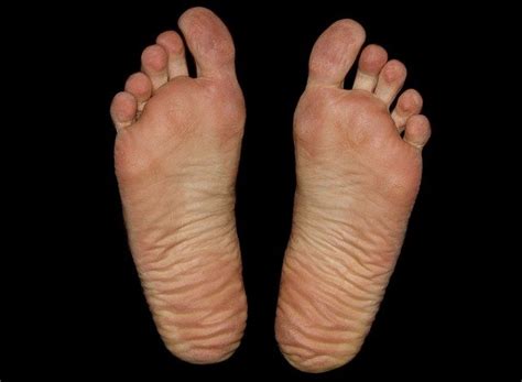 Image foot-5 : Feet Foot Sole - Free photo on Pixabay
