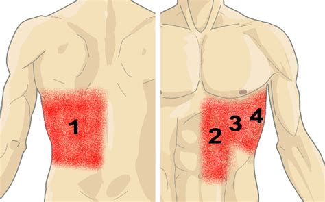 Pain in right side under rib cage causes. Pin on Rib pain