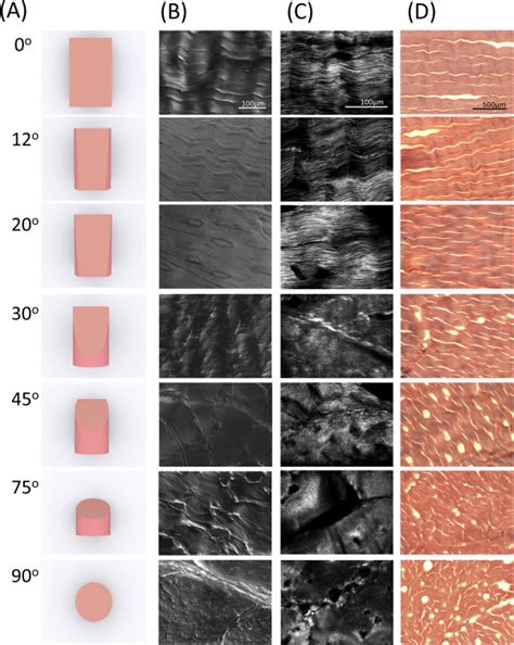 Insertional achilles tendonitis involves the lower portion of the heel where the tendon inserts to the heel bone. Histology of cut angle of bovine Achilles tendon sections ...