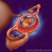 Sama seperti tanda kehamilan di minggu pertama, maka kehamilan di luar kandungan juga menyebabkan ibu terlambat datang bulan. Kehamilan luar rahim