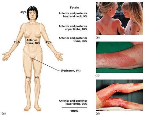 Labelled pictures of human skin : 17 Best images about integumentary on Pinterest | Study ...