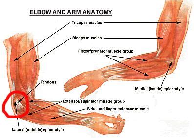 Epicondylitis is a painful chronic inflammation of the tendons at either the medial or lateral epicondyles of the elbow. Pin on Anatomy and Physical Therapy