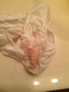 Your pregnancy at 7 weeks. Light Pink Spotting When I Wipe 2 Weeks After Period ...
