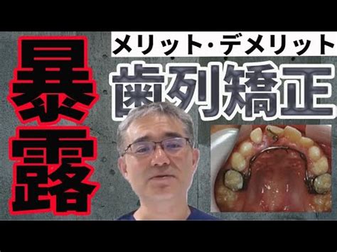 このアカウントには、性的興奮を催すリンクや破廉恥な画像を多数含みます。 もし嫌悪感を感じたらミュートないしはブロック下さい。 #uncensored #無修正 #pornstar #av女優. 矯正 イケメンになった, 歯並びが綺麗になってイケメンになっ ...