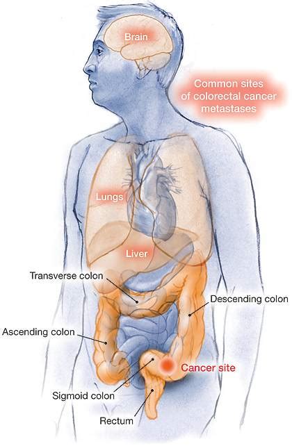 These countries include those with the highest burden of cervical cancer in. Think Heavenly Corporation, Hpv vaccine malaysia price