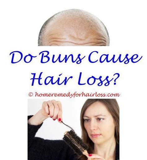 Check spelling or type a new query. vitamin for hair loss in dogs - herbs for hair loss ...