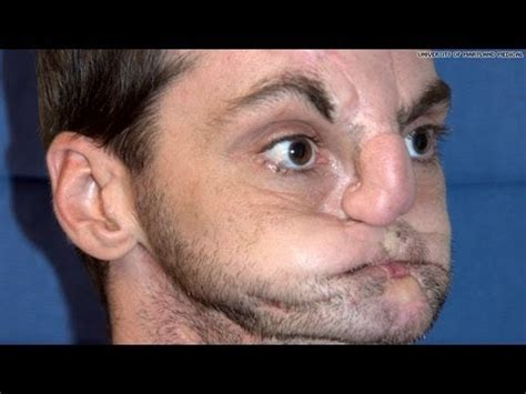 Последние твиты от face to face (@facetofacemusic). Face Transplant After Being Shot In The Face! - YouTube