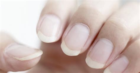 In fact, a doctor can tell if you have a discoloration of nails and brittleness could be caused due to the vitamin deficiency. Are Ridged Nails and Dry Skin a Sign of Vitamin Deficiency ...