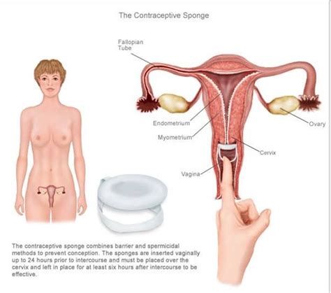If you use a condom every time you have sex, it has a 98% theoretical effectiveness rate of preventing pregnancy. Non Hormonal Birth Control | best non-hormonal birth ...