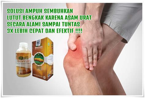 Maybe you would like to learn more about one of these? Cara Mengobati Lutut Bengkak Karena Asam Urat Secara Alami ...
