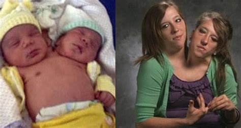 For those who don't know about these two sisters, though, abigail and brittany hensel are a set of conjoined twins that share a body but have two separate heads. 30 Fun Things About Conjoined Twins Abby and Brittany Hensel - The Frisky