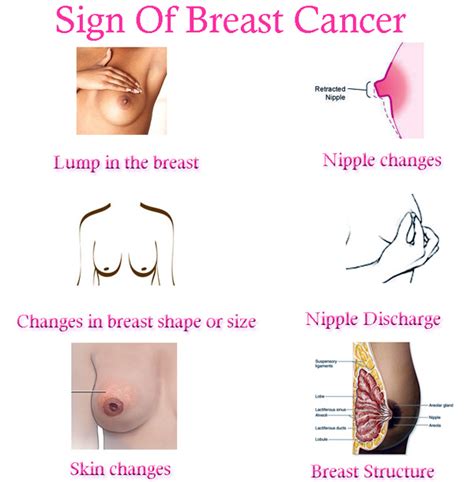 There is a very important video that every woman must see about a silent killer. Breast Cancer Pictures: Sign Of Breast Cancer