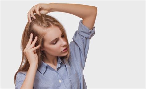 Potential causes of hair loss: Alopecia - Abnormal hair loss, androgenic alopecia ...