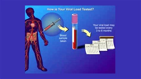 These are the most reliable tests for detecting active. PCR-RNA-viral-load-test-hiv- STD Testing Near Me