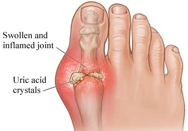 Uric acid is produced from the natural breakdown of body's cells and from the foods we eat. Facts Fun: URIC ACID LEVEL & DIETS