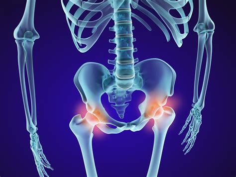 Le premier symptôme est bien sûr la douleur très vive dans le haut de la cuisse et au niveau du bassin. Col du fémur : le traitement par ostéosynthèse par plaque