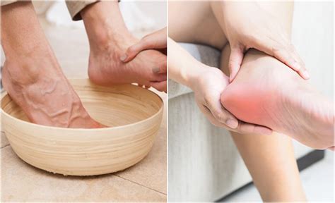 Cara hilangkan sakit tumit kaki. Ini Petua Untuk Hilangkan Sakit Kaki Cara Tradisional ...
