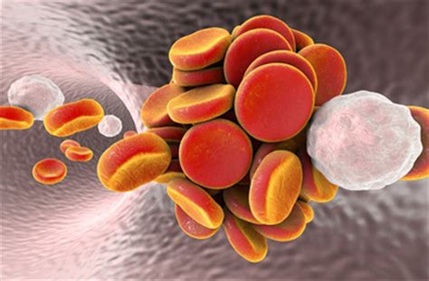 Bei einer thrombose bildet sich ein blutgerinnsel (ein thrombus) in einem blutgefäß oder im herzen. Deutschland Gesundheit: Klage gegen Bayer - Risiko Pille ...